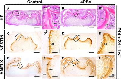The effects of 4-Phenylbutyric acid on ER stress during mouse tooth development